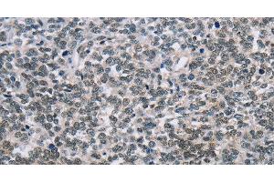 NFKBIL2 antibody