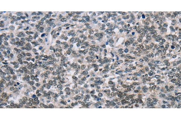 NFKBIL2 antibody