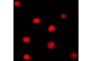 Immunofluorescent analysis of Glucocorticoid Receptor staining in PC12 cells.