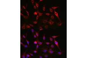 Immunofluorescence analysis of C6 cells using FAK Rabbit pAb (ABIN3022950, ABIN3022951, ABIN3022952 and ABIN6219313) at dilution of 1:100 (40x lens). (FAK antibody)