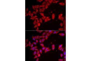 Immunofluorescence analysis of HeLa cells using SLC35A2 antibody (ABIN5974358). (SLC35A2 antibody)