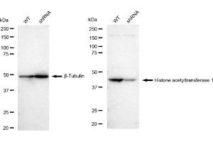 Western blotting analysis using Histone acetyltransferase 1 antibody (ABIN7798921). (Recombinant HAT1 antibody)