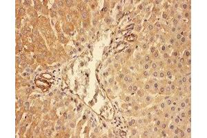 IHC-P: C5a antibody testing of rat liver tissue (C5A antibody  (N-Term))