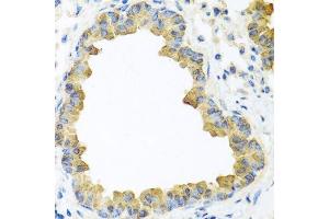 Immunohistochemistry of paraffin-embedded mouse lung using WNT5B antibody. (WNT5B antibody  (AA 120-359))