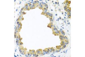Immunohistochemistry of paraffin-embedded mouse lung using WNT5B antibody.