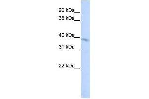 TMEM82 antibody used at 1 ug/ml to detect target protein. (TMEM82 antibody  (N-Term))