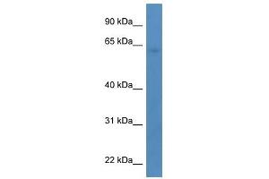 Western Blot showing TBC1D10A antibody used at a concentration of 1-2 ug/ml to detect its target protein. (TBC1D10A antibody  (C-Term))