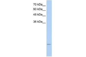 WB Suggested Anti-UBE2I Antibody Titration:  2. (UBE2I antibody  (N-Term))