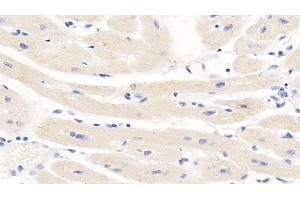 Detection of TNFb in Human Cardiac Muscle Tissue using Monoclonal Antibody to Tumor Necrosis Factor Beta (TNFb) (LTA antibody  (AA 36-205))