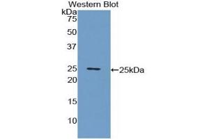 Detection of Recombinant CRP, Porcine using Polyclonal Antibody to C Reactive Protein (CRP) (CRP antibody  (AA 20-222))