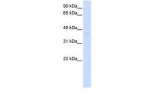 Image no. 1 for anti-Ganglioside-Induced Differentiation-Associated Protein 1-Like 1 (GDAP1L1) (AA 74-123) antibody (ABIN6738620) (GDAP1L1 antibody  (AA 74-123))