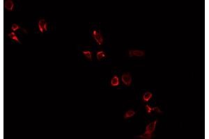 ABIN6269209 staining PC-3 cells by IF/ICC. (NOS1 antibody  (Internal Region))