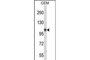 Western blot analysis of ITGB3 Antibody (C-term) (ABIN652616 and ABIN2842411) in CEM cell line lysates (35 μg/lane). (Integrin beta 3 antibody  (C-Term))