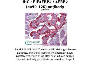 Image no. 1 for anti-Eukaryotic Translation Initiation Factor 4E Binding Protein 2 (EIF4EBP2) (AA 99-120) antibody (ABIN1733956) (eIF4EBP2 antibody  (AA 99-120))