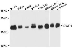 Western blot analysis of extracts of various cell lines, using VAMP4 antibody. (VAMP4 antibody  (AA 1-115))