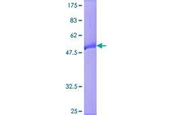 RAB9B Protein (GST tag)