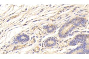 Detection of SPINK5 in Human Uterus Tissue using Polyclonal Antibody to Serine Peptidase Inhibitor Kazal Type 5 (SPINK5) (SPINK5 antibody  (AA 699-976))