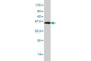 Western Blot detection against Immunogen (35. (RORB antibody  (AA 136-224))
