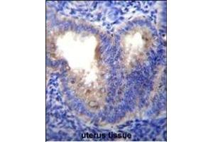 EIF5AL1 Antibody (C-term) (ABIN655925 and ABIN2845320) immunohistochemistry analysis in formalin fixed and paraffin embedded human uterus tissue followed by peroxidase conjugation of the secondary antibody and DAB staining. (EIF5AL1 antibody  (C-Term))