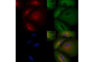 ABIN6257061 and ABIN6274183 staining  cells by IF/ICC.