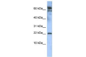 Western Blotting (WB) image for anti-Leucine Zipper, Down-Regulated in Cancer 1 (LDOC1) antibody (ABIN2458354) (LDOC1 antibody)