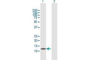 Western Blot analysis of DAAM2 expression in transfected 293T cell line by DAAM2 MaxPab polyclonal antibody. (DAAM2 antibody  (AA 1-132))