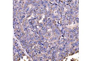 IHC analysis of Drebrin/DBN1 using anti-Drebrin/DBN1 antibody (ABIN7602638). (DBN1 antibody  (AA 9-649))