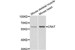 Western blot analysis of extracts of various cell lines, using CRAT antibody. (CRAT antibody)