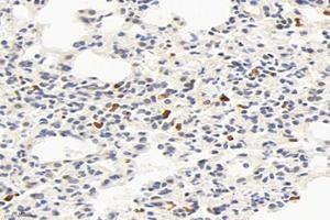 Immunohistochemistry analysis of paraffin-embedded mouse lung using,Factor XIIIa (ABIN7073528) at dilution of 1: 2400 (F13A1 antibody)