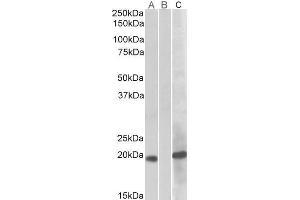 HEK293 lysate (10ug protein in RIPA buffer) overexpressing Human HOXA1 (RC222721) with C-terminal MYC tag probed with ABIN571120 (1ug/ml) in Lane A and probed with anti-MYC Tag (1/1000) in lane C.