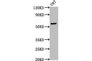 Western Blot Positive WB detected in: U87 whole cell lysate All lanes: PRAMEF17 antibody at 1:2000 Secondary Goat polyclonal to rabbit IgG at 1/50000 dilution Predicted band size: 55 kDa Observed band size: 55 kDa (PRAMEF17 antibody  (AA 69-259))