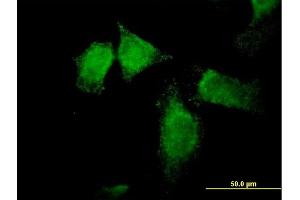 Immunofluorescence of purified MaxPab antibody to SNX13 on HeLa cell. (SNX13 antibody  (AA 1-957))