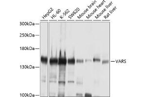 Western blot analysis of extracts of various cell lines, using VARS antibody (ABIN1683239, ABIN3018665, ABIN3018666 and ABIN6220533) at 1:1000 dilution. (VARS antibody  (AA 1-280))