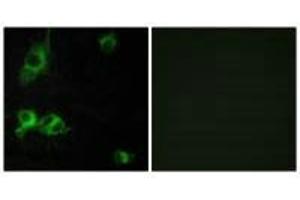 Immunofluorescence analysis of COS-7 cells, using LAMA1 antibody. (Laminin alpha 1 antibody)
