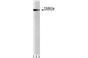 Western blot analysis of p150 [Glued] on a human endothelial cell lysate. (Dynactin 1 antibody  (AA 3-202))