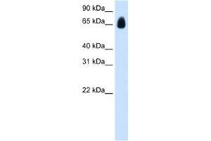 WB Suggested Anti-TRIM32 Antibody Titration:  1. (TRIM32 antibody  (C-Term))
