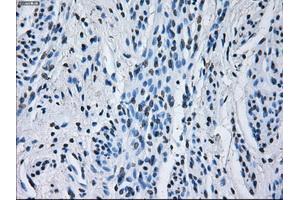 Immunohistochemical staining of paraffin-embedded Kidney tissue using anti-RNF144Bmouse monoclonal antibody.