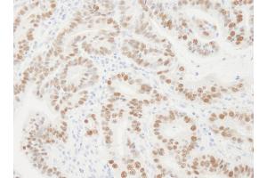 Immunohistochemistry (IHC) image for anti-Proliferating Cell Nuclear Antigen (PCNA) (AA 75-125) antibody (ABIN7454604) (PCNA antibody  (AA 75-125))