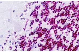 Human Brain, Cerebellum: Formalin-Fixed, Paraffin-Embedded (FFPE) (PDX1 antibody  (AA 27-76))