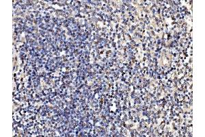 IHC analysis of Kinectin 1/KTN1 using anti-Kinectin 1/KTN1 antibody (ABIN7601096). (KTN1 antibody  (AA 283-827))