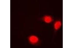 Immunofluorescent analysis of Transketolase staining in Jurkat cells. (TKT antibody)