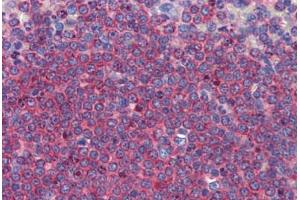 Human Spleen: Formalin-Fixed, Paraffin-Embedded (FFPE) (ALDH5A1 antibody  (C-Term))