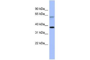 WB Suggested Anti-MAGEB1 Antibody Titration: 0. (MAGEB1 antibody  (Middle Region))