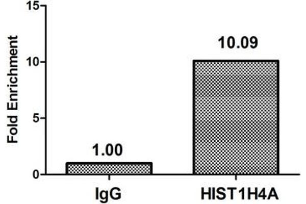 HIST1H4A antibody  (acLys16)