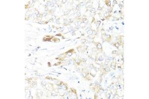 Immunohistochemistry (Paraffin-embedded Sections) (IHC (p)) image for anti-Hydroxysteroid (17-Beta) Dehydrogenase 10 (HSD17B10) (AA 1-261) antibody (ABIN6142004)