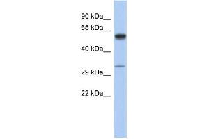 WB Suggested Anti-ZDHHC24 Antibody Titration: 0.