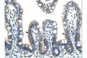 Image no. 1 for anti-BTB (POZ) Domain Containing 6 (BTBD6) (AA 87-136) antibody (ABIN202456) (BTBD6 antibody  (AA 87-136))