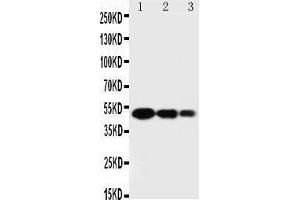 Anti-SPARC antibody, Western blotting Lane 1: Recombinant Human SPARC Protein 10ng Lane 2: Recombinant Human SPARC Protein 5ng Lane 3: Recombinant Human SPARC Protein 2.