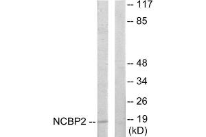 Western blot analysis of extracts from COLO205 cells, using NCBP2 antibody. (NCBP2 antibody  (N-Term))