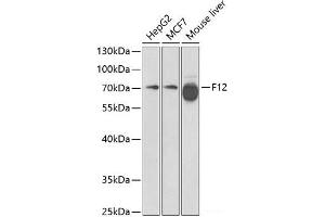 Western blot analysis of extracts of various cell lines using F12 Polyclonal Antibody at dilution of 1:1000. (F12 antibody)